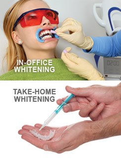 Teeth Whitening In Troy, MI